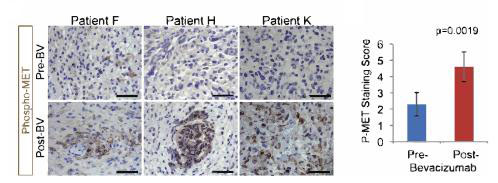 免疫組化圖片數據化分析
