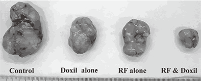 圖片分析腫瘤球大小 圖片分析腫瘤球大小